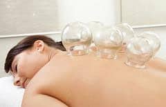 cupping